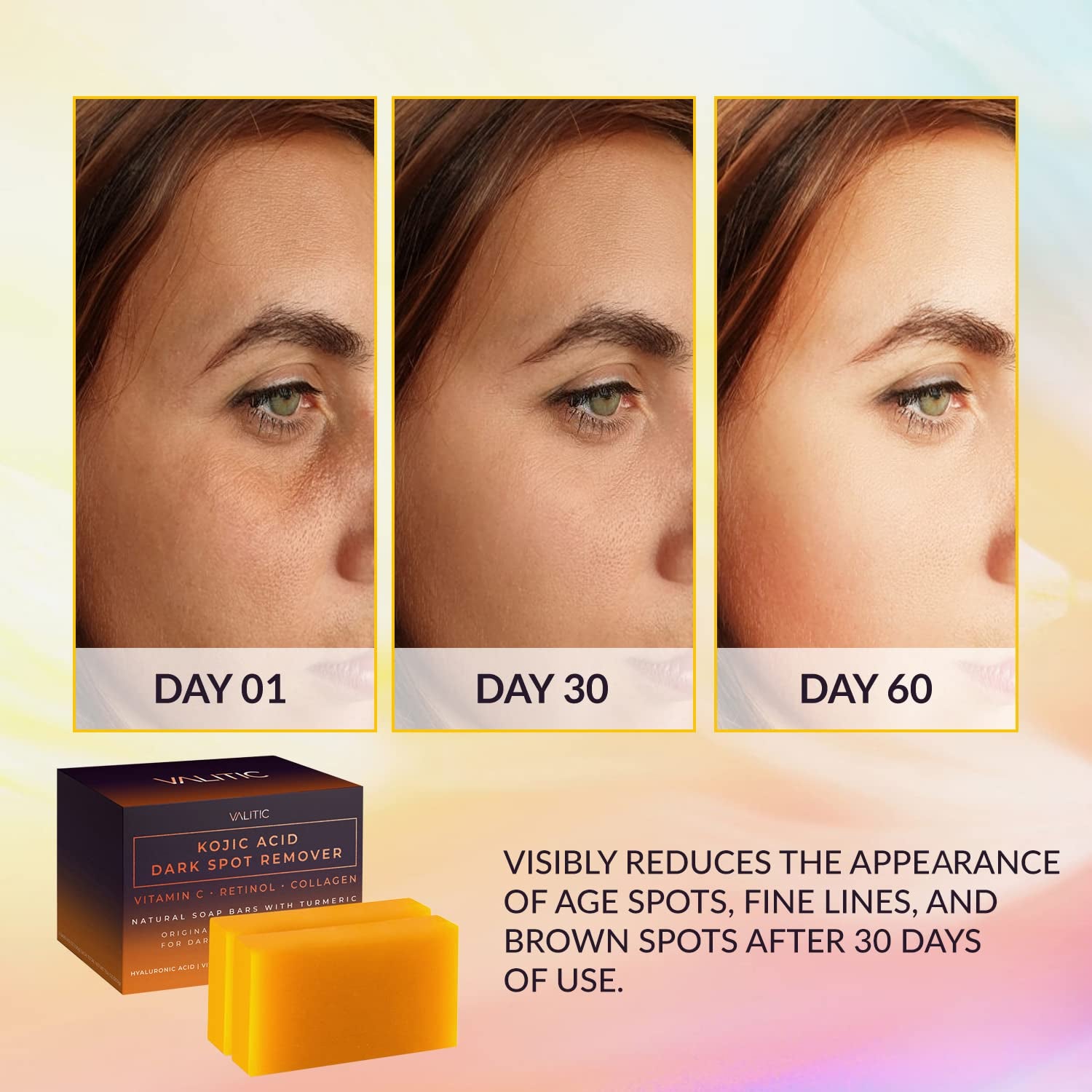 Kojic Bright Complex Soap – 2 Bars for Dark Spot Removal with Vitamin C, Retinol, Turmeric & Hyaluronic Acid | Japanese-Infused Glow with Natural Oils