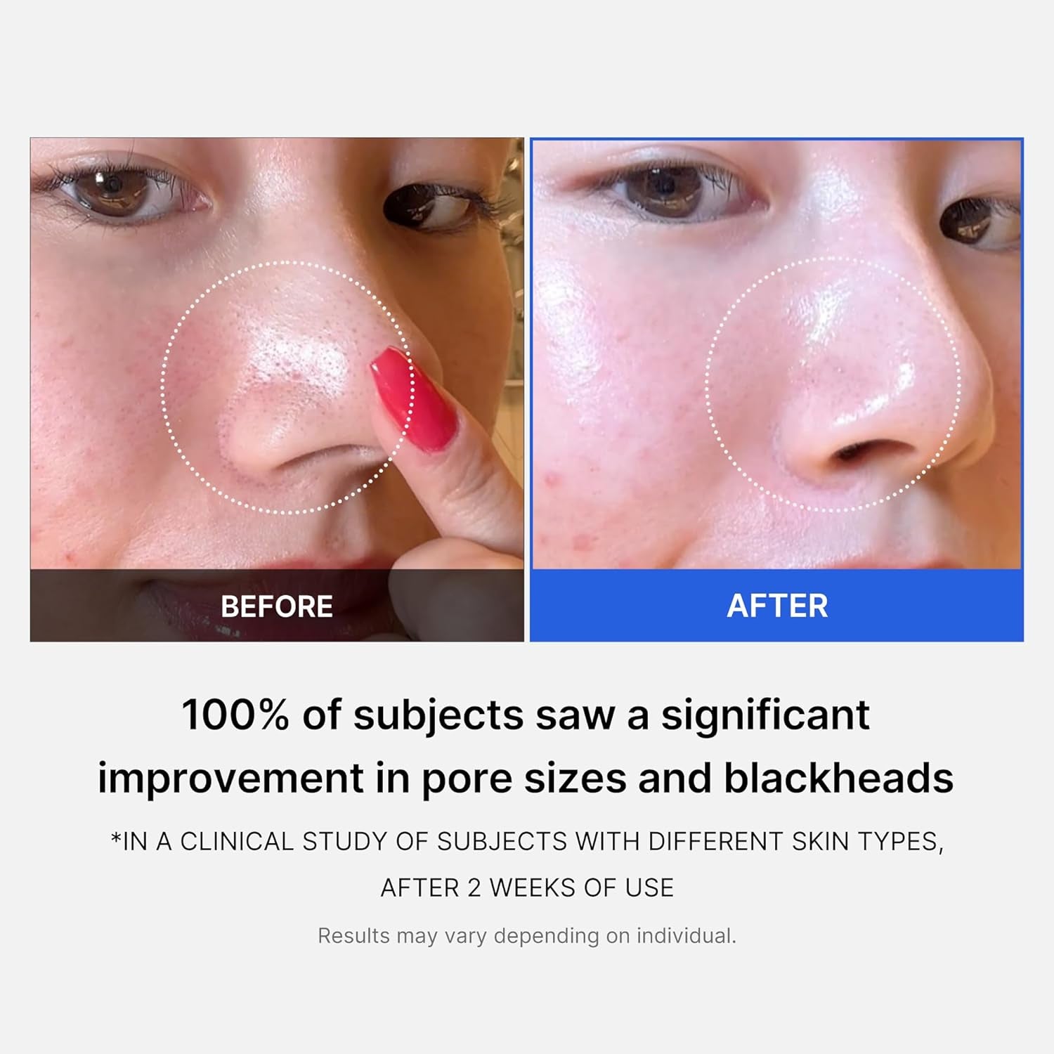 Zero Pore Pads 2.0 – Exfoliating Toner Pads with 4.5% Lactic Acid & 0.45% Salicylic Acid | Refine Pores & Smooth Texture | 70 Korean Beauty Pads