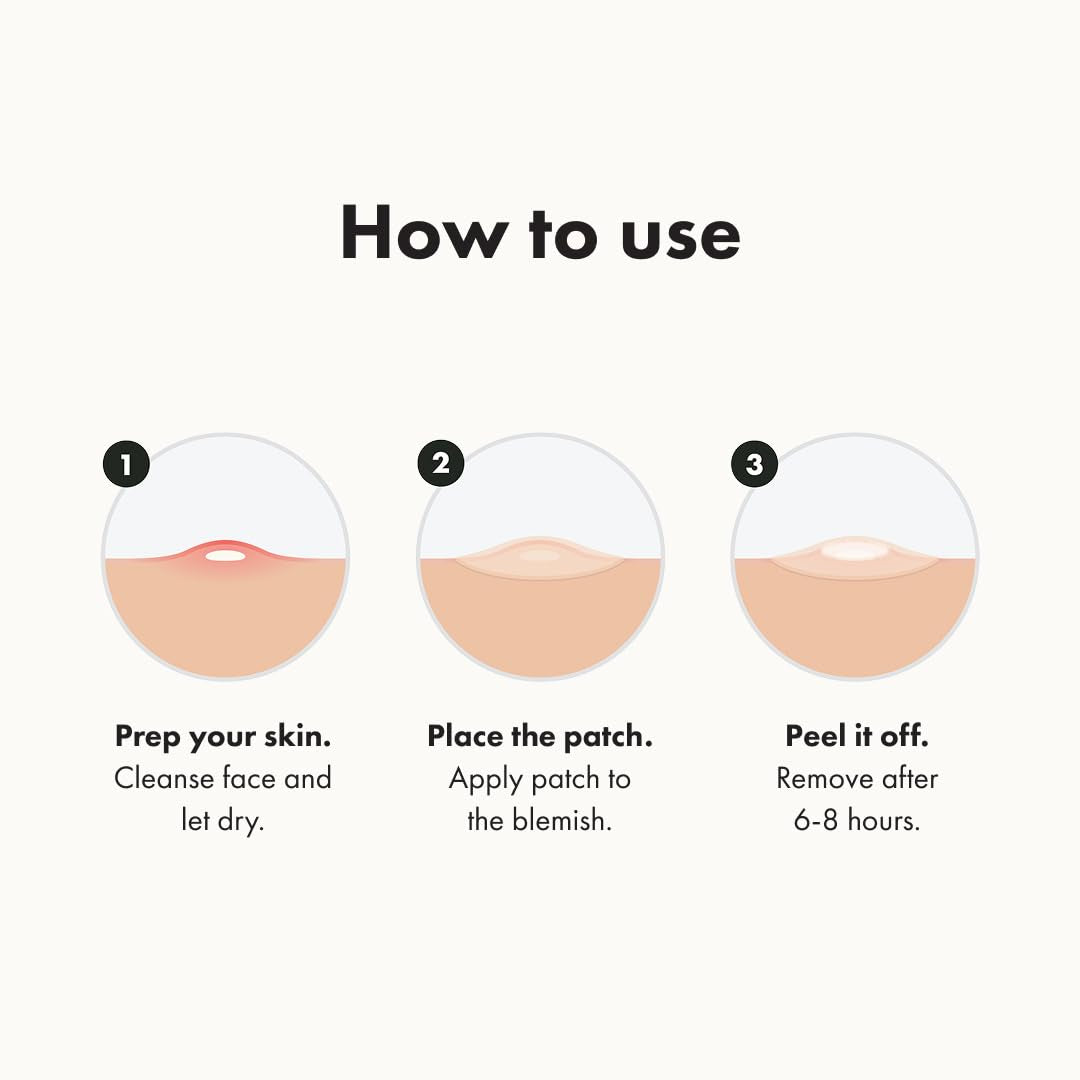 Hero™ Original Acne Patch – Fast-Acting Hydrocolloid Stickers That Shrink Pimples in 1 Use | 36 Spot-Saving Patches for Clearer Skin