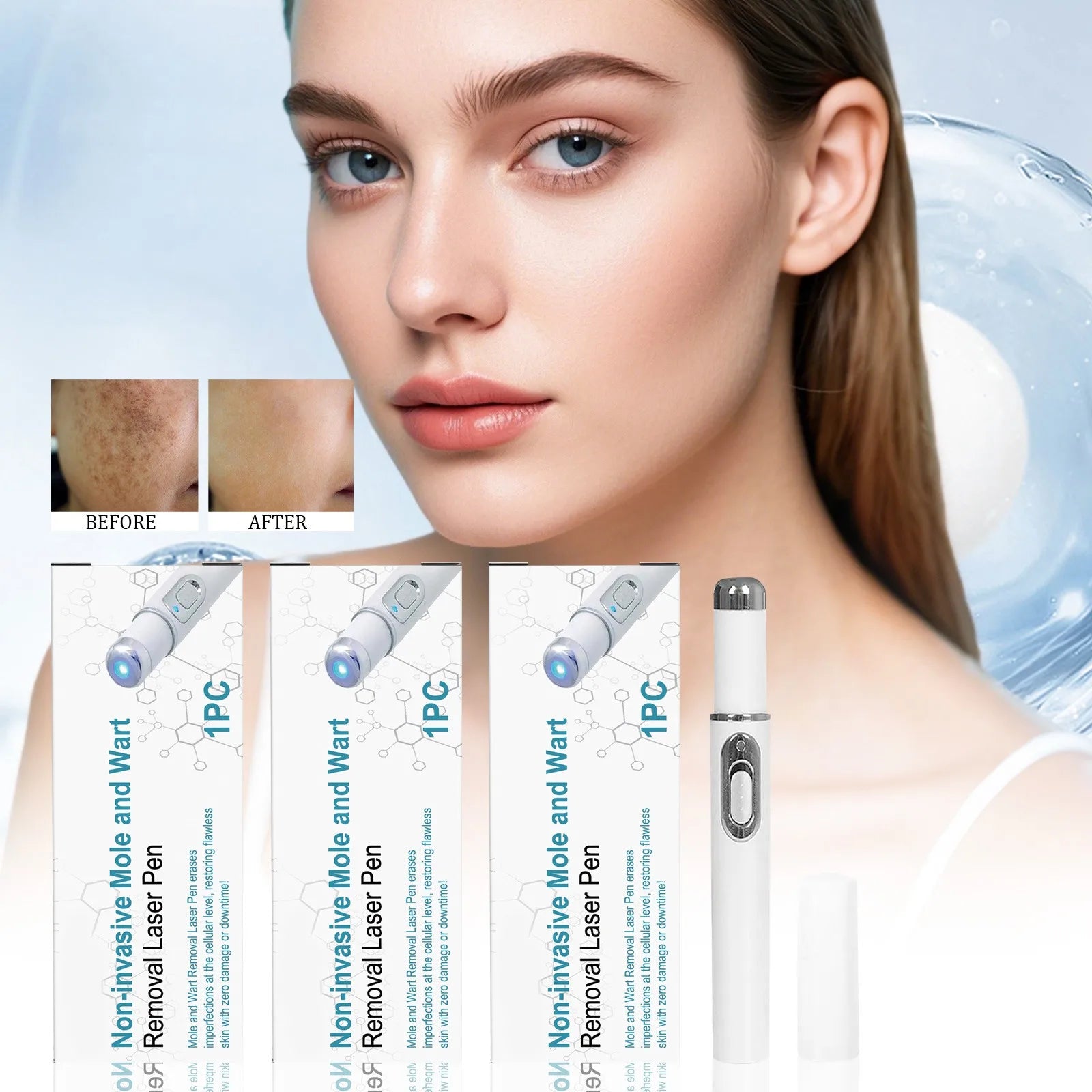 Blue Light Clear Pen – Fast & Easy Mole and Pigmentation Correction Without Pain or Scars