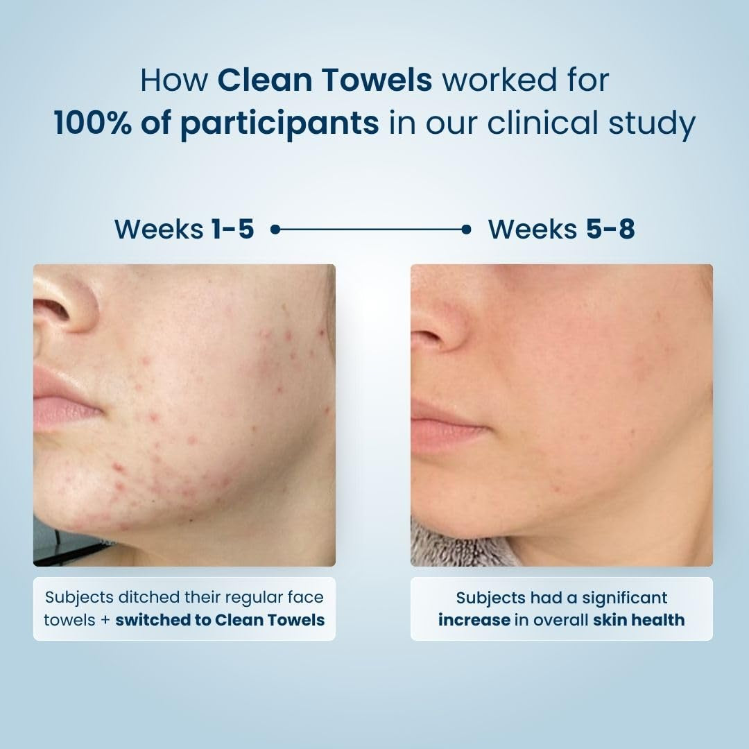 Clean Towels XL™ – 100% USDA Biobased Disposable Face Towels | Ultra-Soft, Eczema Association Accepted | Perfect for Makeup Removal & Sensitive Skin | 50 Count