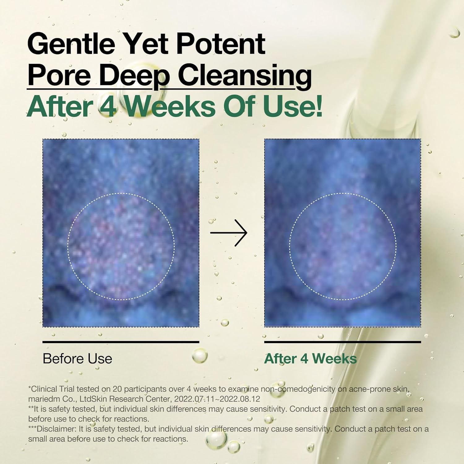 Heartleaf Glow Cleansing Oil – Gentle Korean Formula for Pore Purifying, Blackhead Removal & Makeup Melting | 6.76 fl oz of Botanical Clean